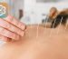 طب آلترناتیو